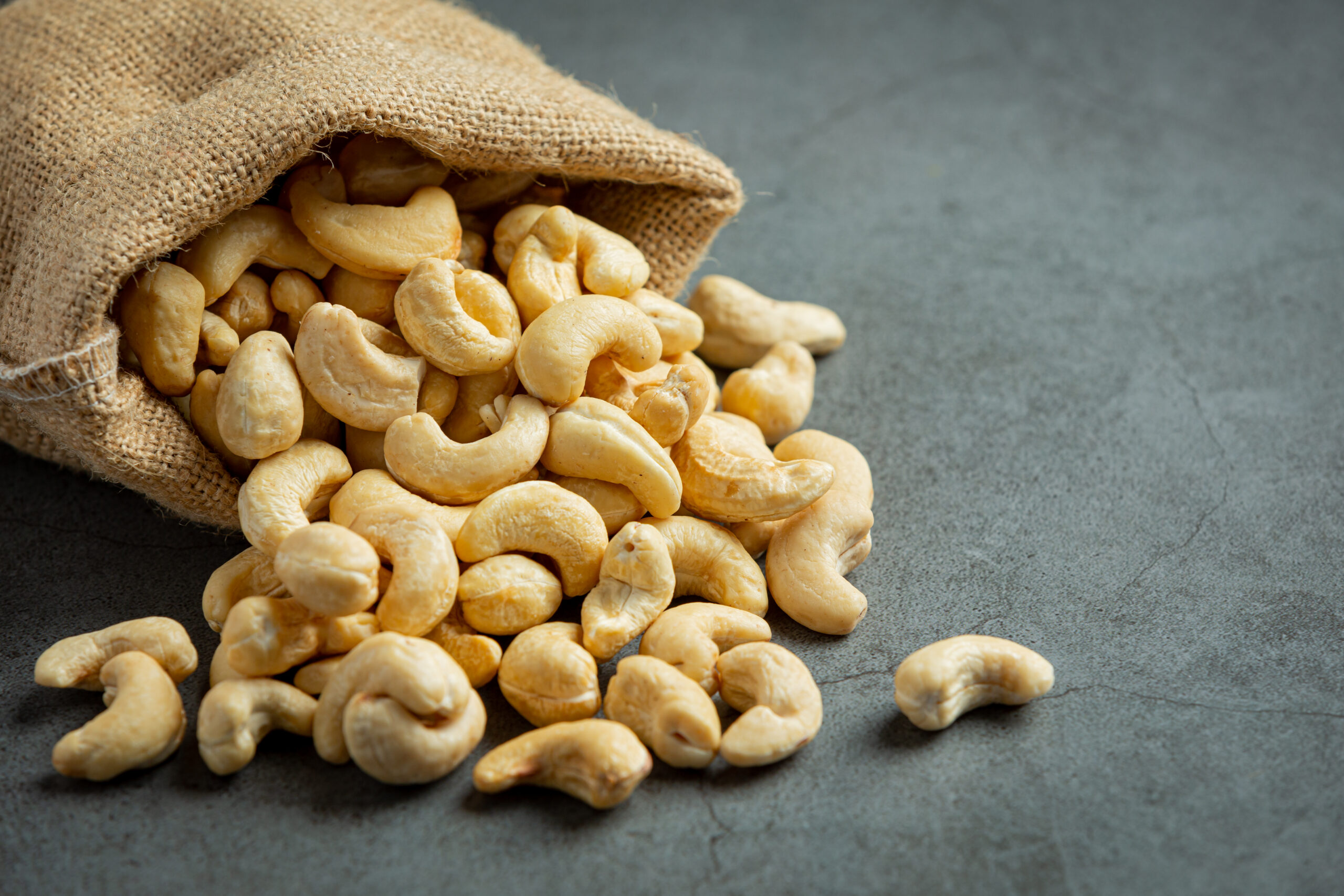 The Health Benefits of Cashew Nuts: Why You Should Make Them a Part of Your Diet